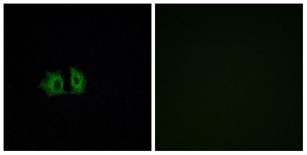 a04292 1 fzd5 primary antibodies if testing 1