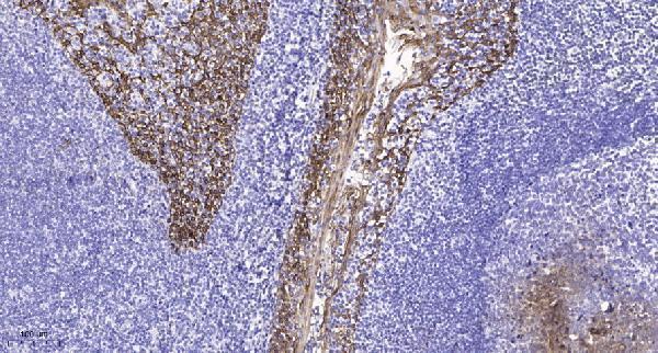 a04292 1 fzd5 primary antibodies ihc testing 3