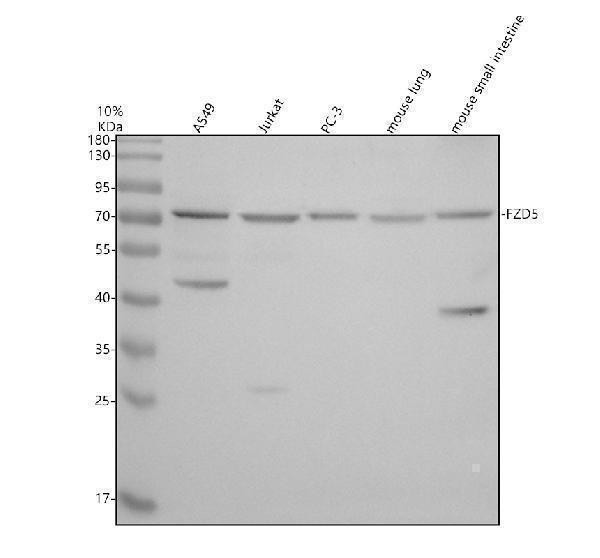 Western blot analysis of FZD5 using anti-FZD5 antibody (A04292-2)