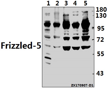 Western blot (WB) analysis of Frizzled-5 (Y500) pAb at 1:500 dilution
Lane1:PC12 whole cell lysate(40ug)
Lane2:MEF whole cell lysate(40ug)
Lane3:HEK293T whole cell lysate(40ug)
Lane4:HepG2 whole cell lysate(40ug)
Lane5:K562 whole cell lysate(40ug)