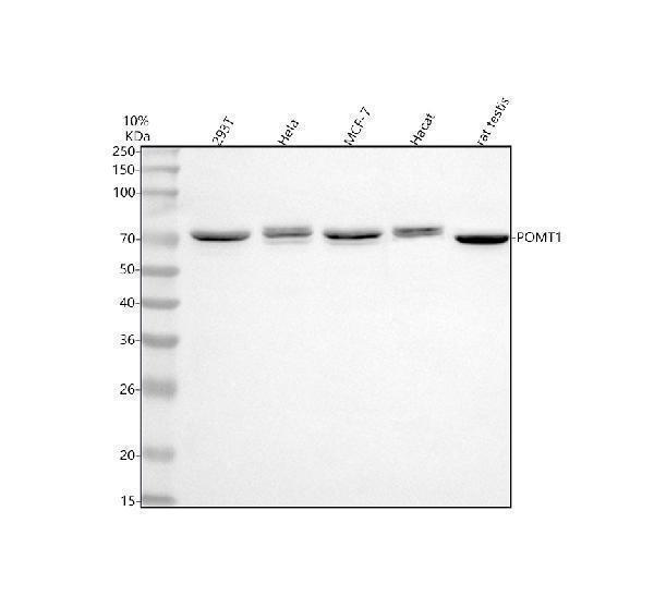  Western blot analysis of POMT1 using anti-POMT1 antibody (A04295-1)