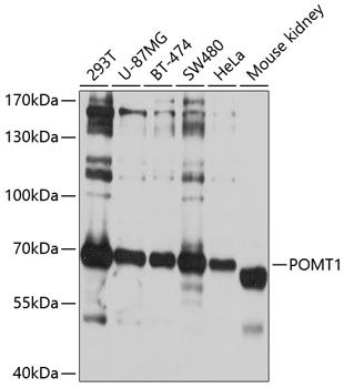 Western blot analysis of extracts of various cell lines, using POMT1 antibody  at 1:1000 dilution