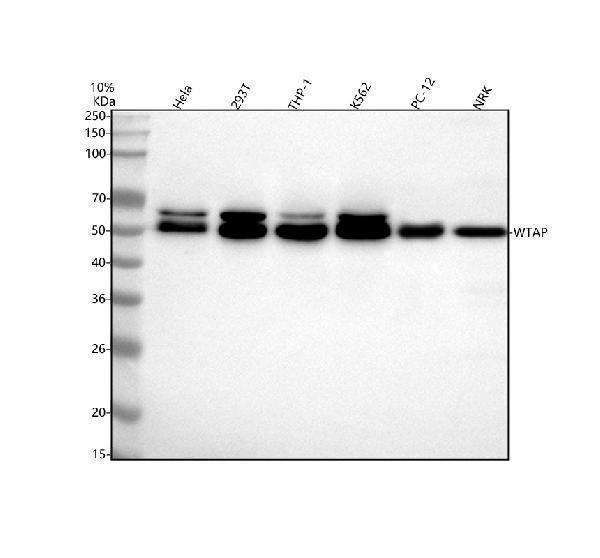  Western blot analysis of WTAP using anti-WTAP antibody (A04296-2)