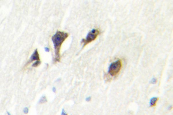 a04297 mapk10 primary antiboties ihc testing 2