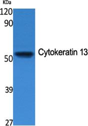 Western Blot analysis of various cells using Cytokeratin 13 Polyclonal Antibody