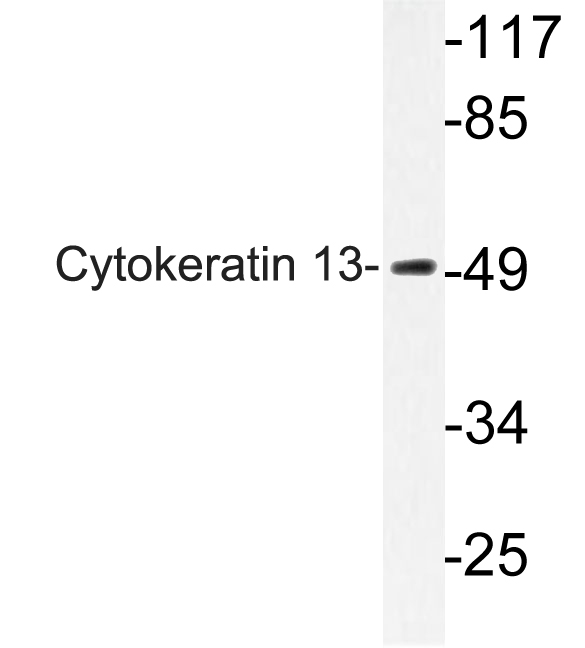 Western blot analysis of lysate from HepG2 cells, using Cytokeratin 13 antibody