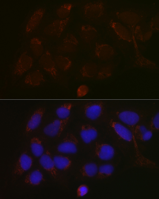 a04300 galnt3 primary antiboties if testing 3