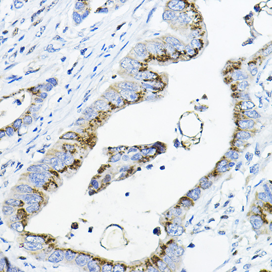a04300 galnt3 primary antiboties ihc testing 2