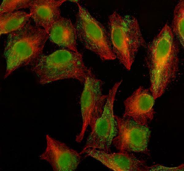 IF analysis of PARG using anti-PARG antibody (A04301-1) and anti-Beta Tubulin antibody (M01857-3)