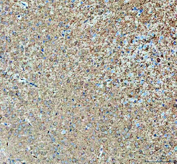  IHC analysis of ABI2 using anti-ABI2 antibody (A04302)