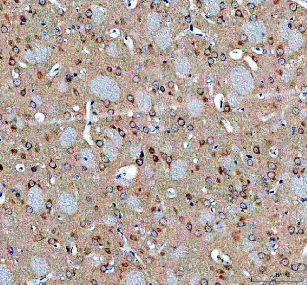 a04302 abi2 primary antibodies ihc testing 3