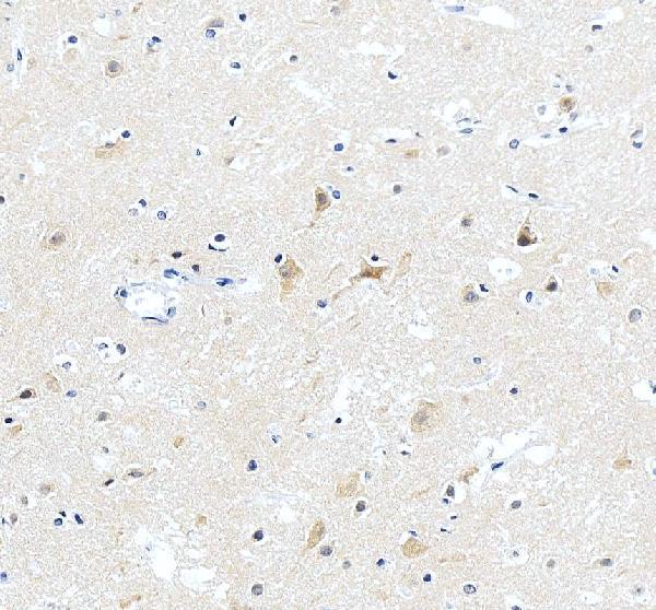 IHC analysis of ABI2 using anti-ABI2 antibody (A04302)