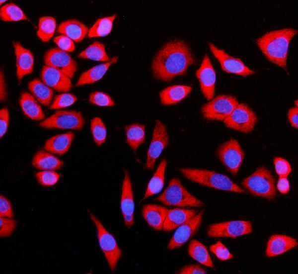 a04303 2 gigyf2 primary antibodies if testing 4