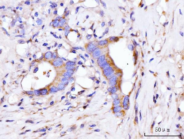  IHC analysis of GIGYF2 using anti-GIGYF2 antibody (A04303-2)