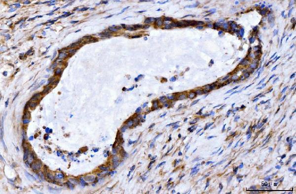 IHC analysis of GIGYF2 using anti-GIGYF2 antibody (A04303-2)