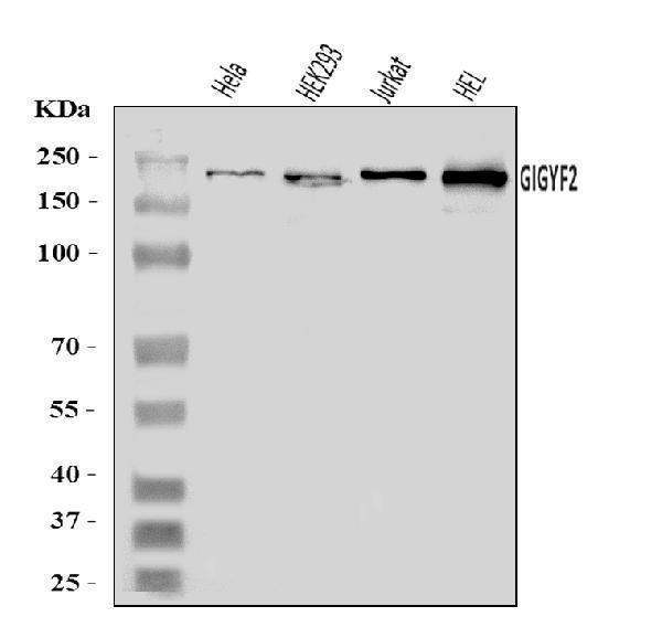  Western blot analysis of GIGYF2 using anti-GIGYF2 antibody (A04303-2)