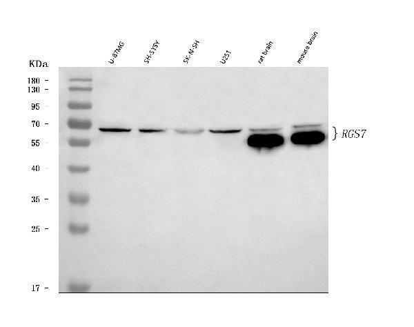  Western blot analysis of RGS7 using anti-RGS7 antibody (A04305-1)