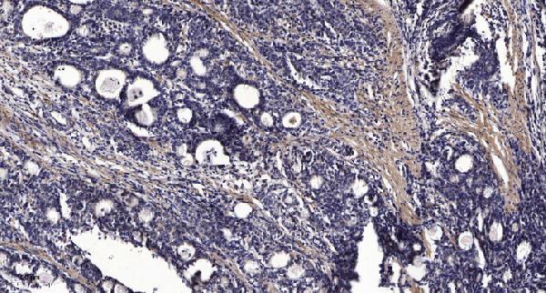 a04305 rgs7 primary antibodies ihc testing 1