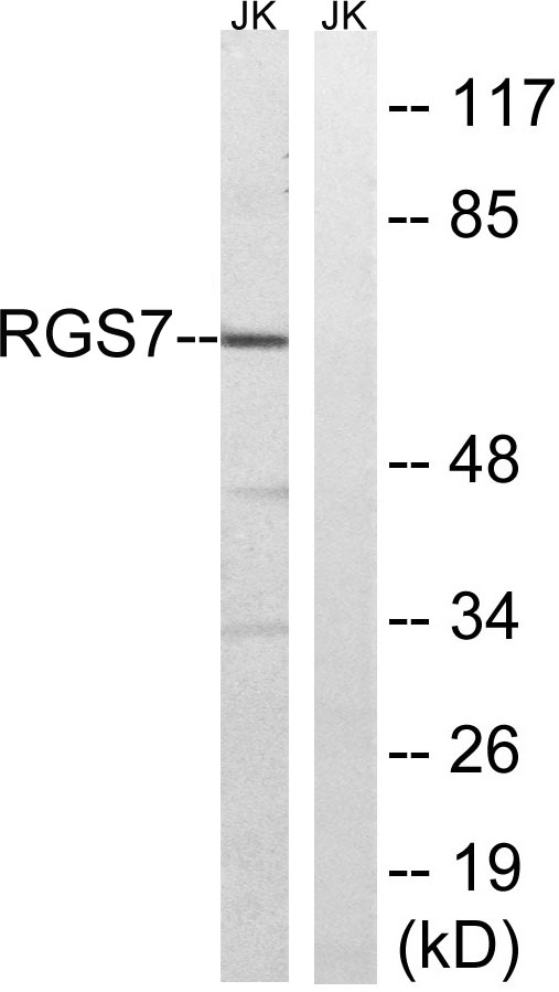 a04305 rgs7 primary antibodies wb testing 2