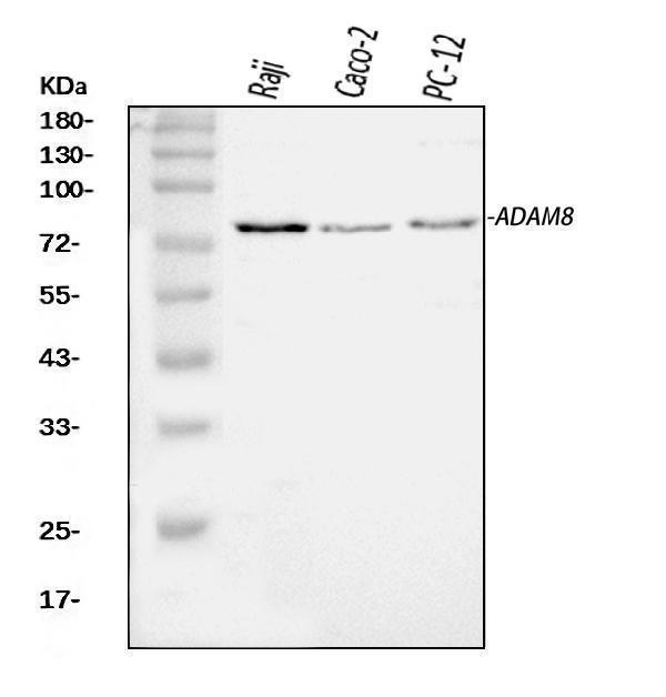  Western blot analysis of MS2/ADAM8 using anti-MS2/ADAM8 antibody (A04306-4)