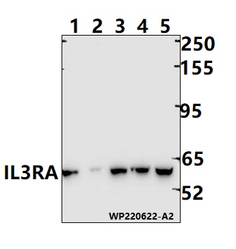 Western blot (WB) analysis of IL3RA polyclonal antibody at 1:1000 dilution
Lane1:CT-26 whole cell lysate(30ug)
Lane2:C6 whole cell lysate(30ug)
Lane3:HepG2 whole cell lysate(30ug)
Lane4:HCT116 whole cell lysate(30ug)
Lane5:A549 whole cell lysate(30ug)