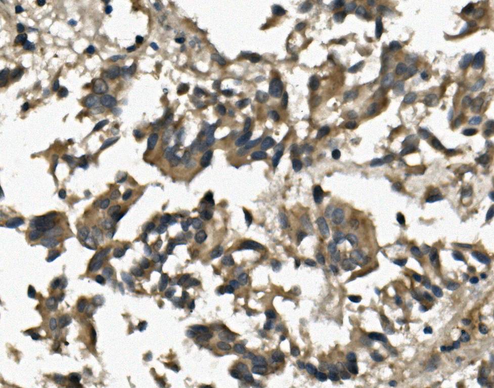 IHC analysis of IL3RA using anti-IL3RA antibody (A04307)