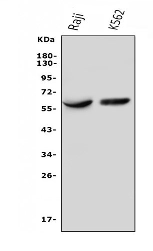  Western blot analysis of IL3RA using anti-IL3RA antibody (A04307)