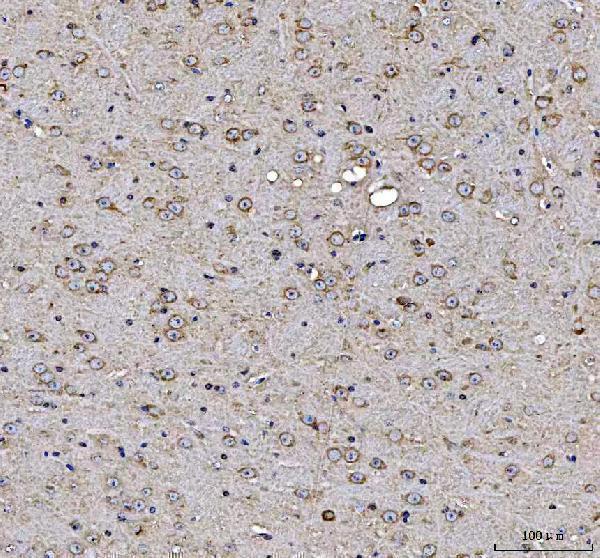 a04308 map1s primary antibodies ihc testing 2