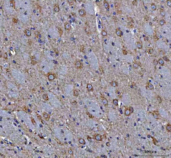 a04308 map1s primary antibodies ihc testing 3