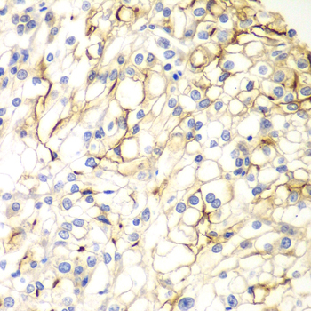 a04309 vangl2 primary antiboties ihc testing 2
