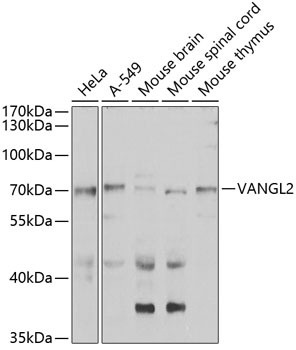 a04309 vangl2 primary antiboties wb testing 1