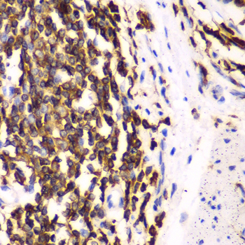 Immunohistochemistry of paraffin-embedded human esophagus using HCLS1 antibody  at dilution of 1:100 