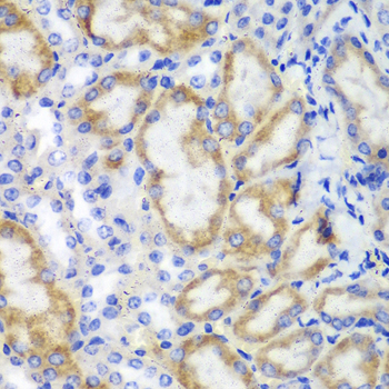 a04313 hcls1 primary antiboties ihc testing 4