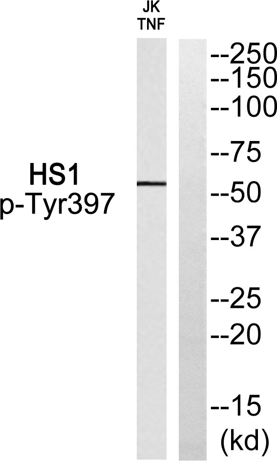 Western blot analysis of HS1 (Phospho-Tyr397) Antibody