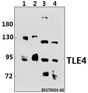 Western blot (WB) analysis of TLE4 (H190) pAb at 1:500 dilution
Lane1:U-87MG whole cell lysate(40ug)
Lane2:HEK293T whole cell lysate(10ug)
Lane3:The Testis tissue lysate of Mouse(40ug)
Lane4:The Testis tissue lysate of Rat(40ug)
