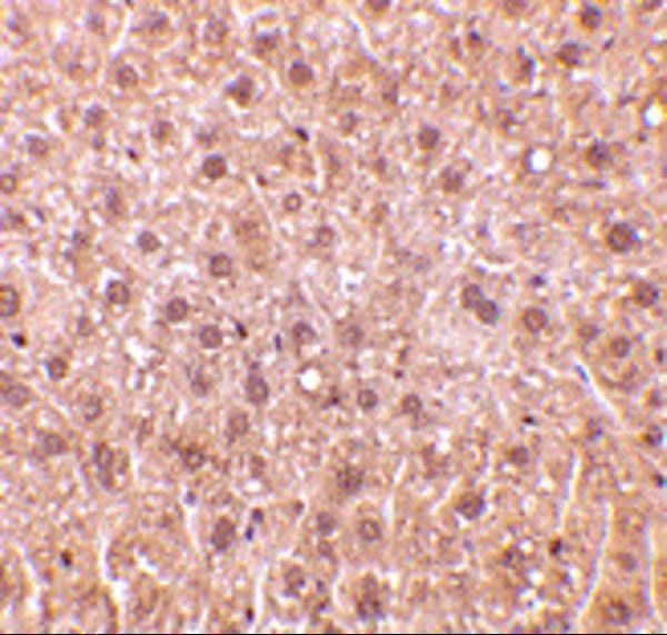 a04316 rybp primary antibodies ihc testing 4