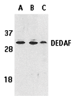 Western blot analysis of DEDAF expression in human A549 (lane A), HepG2 (lane B), and mouse 3T3 (lane C) cell lysates with DEDAF antibody at 1 μg/ml