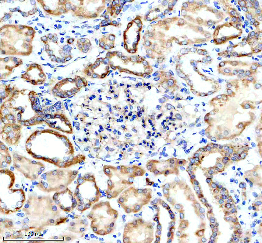 IHC analysis of MGLL using anti-MGLL antibody (A04317-2)