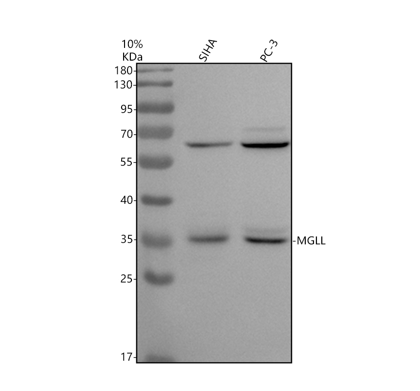 Western blot analysis of MGLL using anti-MGLL antibody (A04317-2)