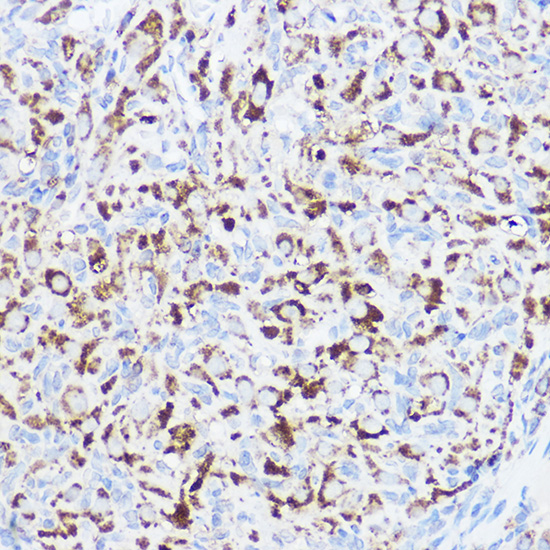 a04317 mgll primary antiboties ihc testing 3