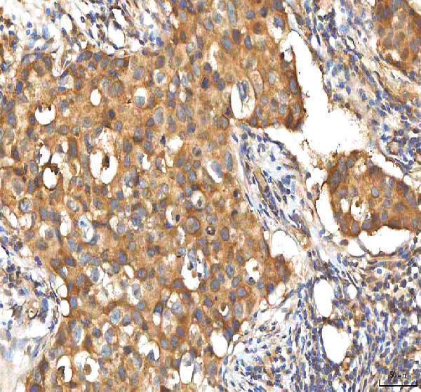  IHC analysis of EIF3B using anti-EIF3B antibody (A04318-1)