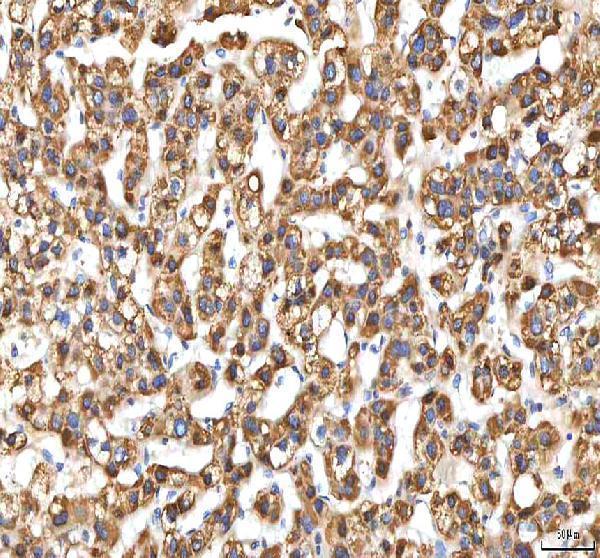  IHC analysis of EIF3B using anti-EIF3B antibody (A04318-1)