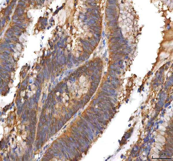 a04318 1 eif3b primary antibodies ihc testing 5
