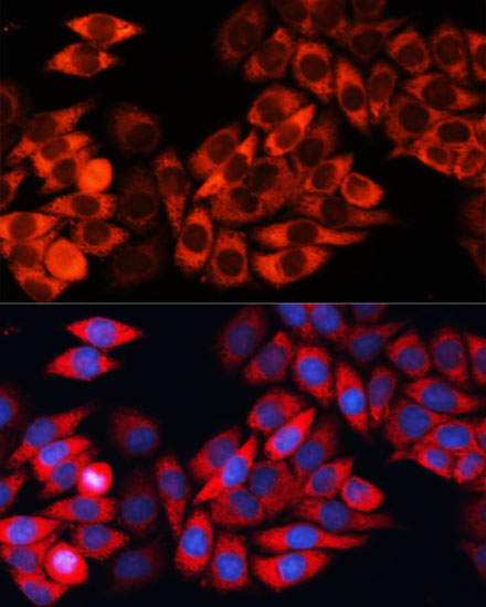 Immunofluorescence analysis of HeLa cells using eIF3B Polyclonal Antibody  at dilution of 1:100 