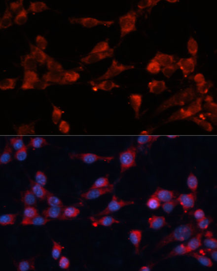 Immunofluorescence analysis of NIH-3T3 cells using eIF3B Polyclonal Antibody  at dilution of 1:100 