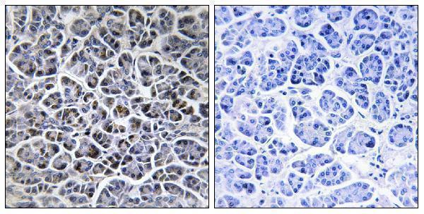 Immunohistochemistry analysis of paraffin-embedded human pancreas tissue, using PPM1K Antibody