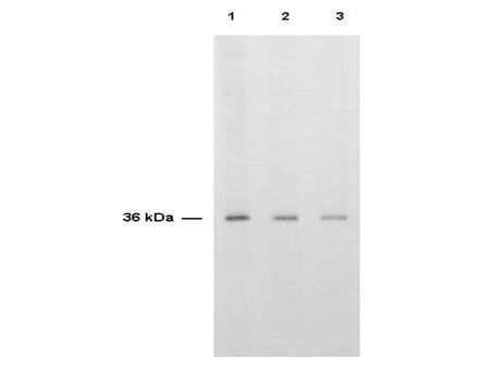 Anti-TS is shown to detect thymidylate synthase present in a HeLa cell extract
