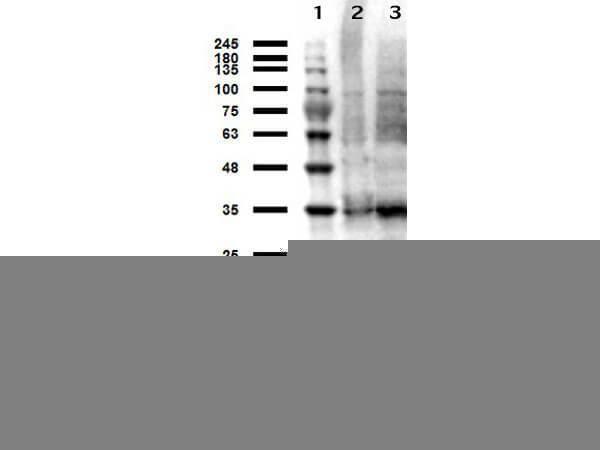 a04320 2 tyms primary antibodies wb testing 2