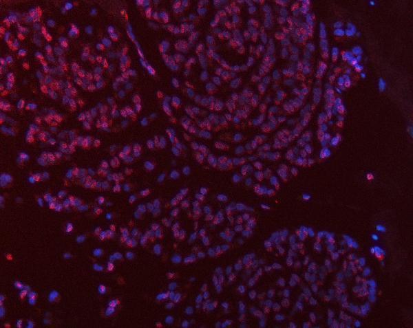 a04320 4 tyms primary antibodies if testing 7