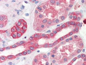 Immunohistochemistry of Thymidylate Synthase antibody